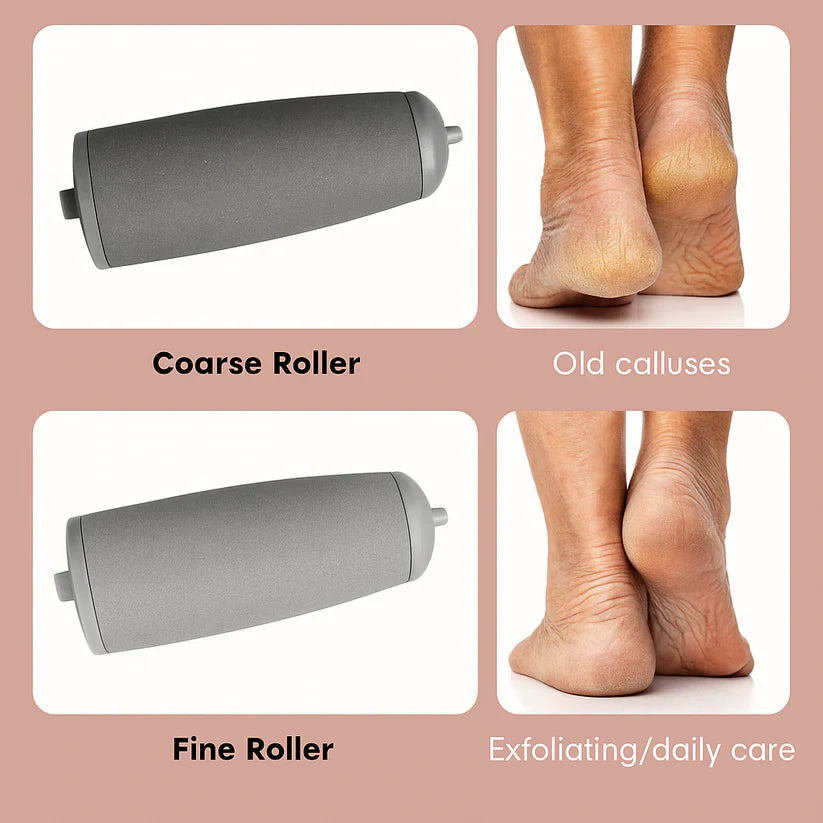 Foot Callus Remover