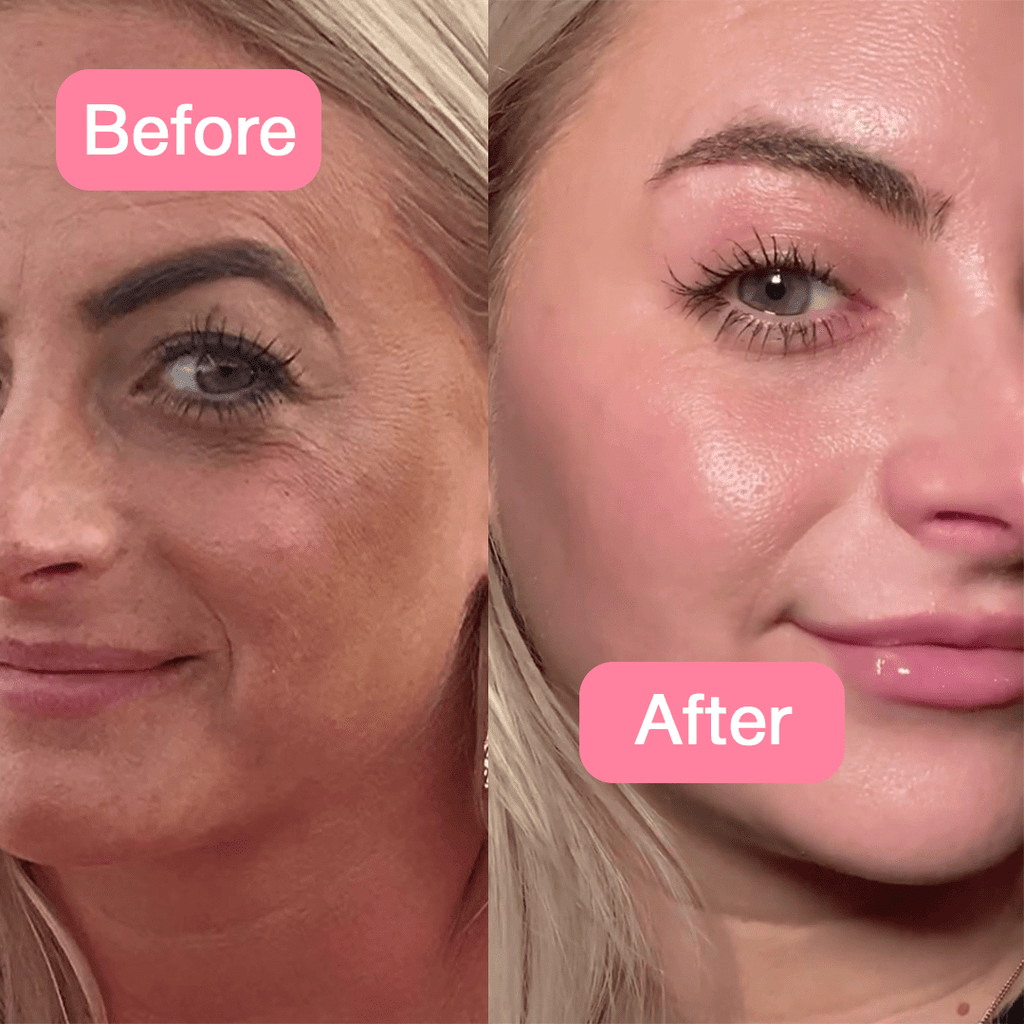 collagen facial jelly